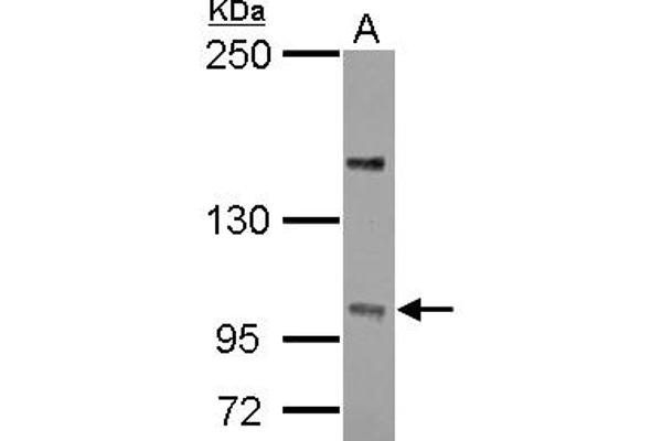 PPP4R4 Antikörper  (C-Term)