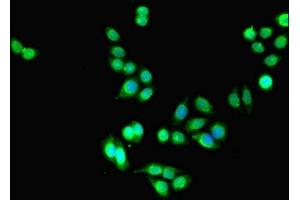 Immunofluorescent analysis of PC-3 cells using ABIN7158230 at dilution of 1:100 and Alexa Fluor 488-congugated AffiniPure Goat Anti-Rabbit IgG(H+L) (DLEU1 Antikörper  (AA 1-78))