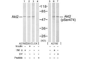Image no. 2 for anti-V-Akt Murine Thymoma Viral Oncogene Homolog 2 (AKT2) (Ser474) antibody (ABIN197359) (AKT2 Antikörper  (Ser474))