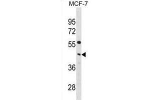 Western Blotting (WB) image for anti-Phosphate Cytidylyltransferase 1, Choline, alpha (PCYT1A) antibody (ABIN3001100) (PCYT1A Antikörper)