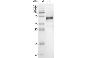 WB analysis of Human OR1E1-Nanodisc with anti-Flag monoclonal antibody at 1/5000 dilution, followed by Goat Anti-Rabbit IgG HRP at 1/5000 dilution (OR1E1 Protein)