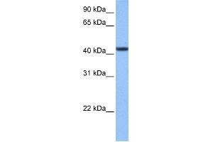 WB Suggested Anti-C8orf34 Antibody Titration: 0. (C8orf34 Antikörper  (N-Term))