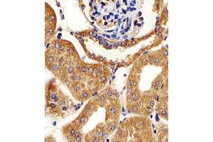 Immunohistochemical analysis of paraffin-embedded M. (AK4 Antikörper  (AA 119-153))