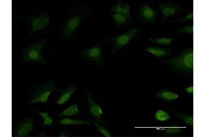 Immunofluorescence of purified MaxPab antibody to PSMB7 on HeLa cell. (PSMB7 Antikörper  (AA 1-277))