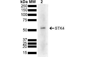 Western blot analysis of Human Cervical cancer cell line (HeLa) lysate showing detection of 55. (STK4 Antikörper  (AA 320-420) (PerCP))