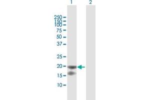 Western Blot analysis of IL1RN expression in transfected 293T cell line by IL1RN MaxPab polyclonal antibody. (IL1RN Antikörper  (AA 1-177))