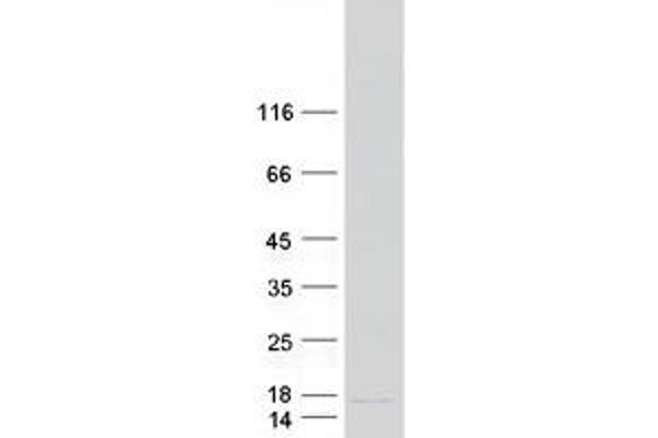 BRP44L Protein (Myc-DYKDDDDK Tag)