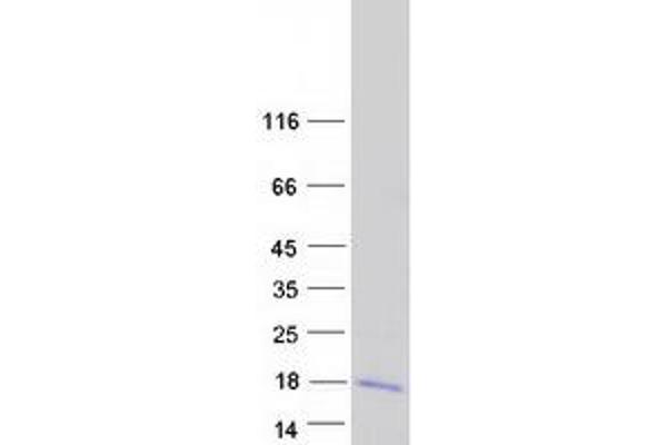 LARP6 Protein (Transcript Variant 2) (Myc-DYKDDDDK Tag)