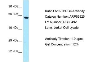 Western Blotting (WB) image for anti-Transforming Growth Factor beta Regulator 4 (TBRG4) (N-Term) antibody (ABIN971851) (TBRG4 Antikörper  (N-Term))