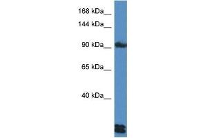 Western Blot showing DSG3 antibody used at a concentration of 1 ug/ml against HepG2 Cell Lysate (Desmoglein 3 Antikörper  (C-Term))