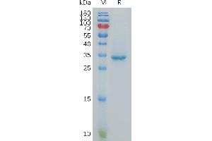 CXORF61 Protein (Fc Tag)