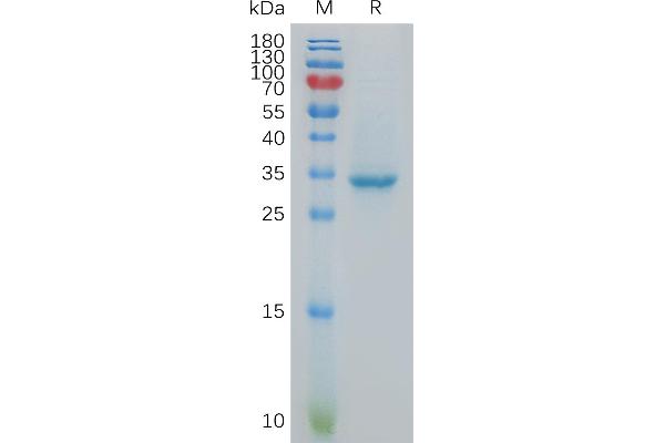 CXORF61 Protein (Fc Tag)