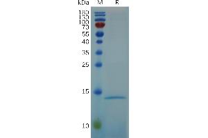 Human RN Protein, His Tag on SDS-PAGE under reducing condition. (RNASE4 Protein (AA 29-147) (His tag))