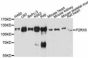 Western blot analysis of extracts of various cell lines, using P2RX5 antibody (ABIN5998432) at 1:3000 dilution. (P2RX5 Antikörper)