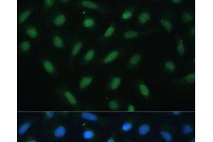 Immunofluorescence analysis of U-2 OS cells using ATF3 Polyclonal Antibody at dilution of 1:100. (ATF3 Antikörper)