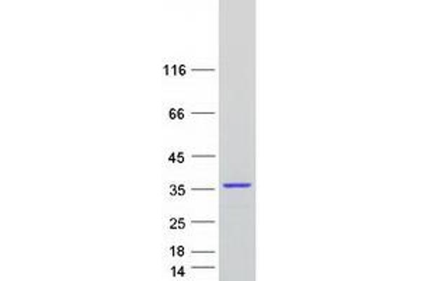 CCDC124 Protein (Transcript Variant 2) (Myc-DYKDDDDK Tag)