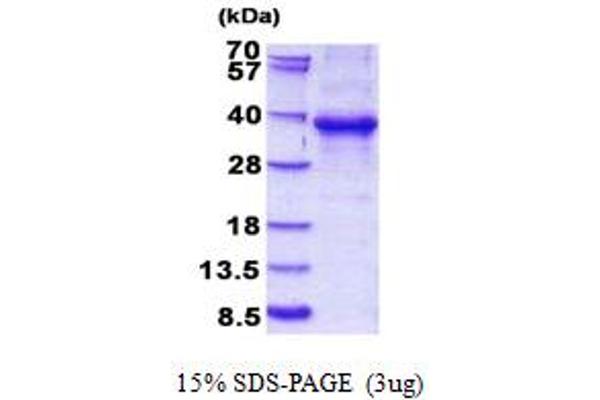 EHF Protein (AA 1-300) (His tag)