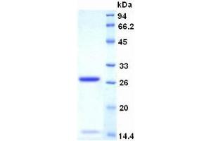 SDS-PAGE analysis of Human Ki-67 Protein. (Ki-67 Protein)