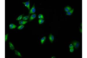 Immunofluorescence staining of Hela cells with ABIN7168823 at 1:33, counter-stained with DAPI. (SEMA6B Antikörper  (AA 756-888))