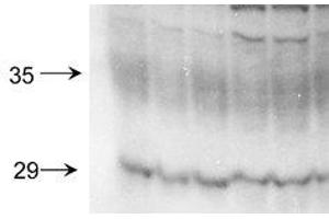 Western Blotting (WB) image for anti-Aquaporin 2 (Collecting Duct) (AQP2) (C-Term) antibody (ABIN6656925)