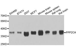 Western blot analysis of extracts of various cell lines, using PPP2CA antibody (ABIN5974047) at 1/1000 dilution. (PPP2CA Antikörper)