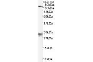 Image no. 1 for anti-NMDA Receptor 1 (NMDA R1) (Internal Region) antibody (ABIN374717) (NMDA 1 Receptor Antikörper  (Internal Region))