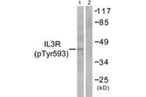 Western blot analysis of extracts from RAW264. (CSF2RB2 Antikörper  (pTyr593))