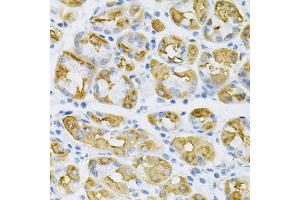 Immunohistochemistry of paraffin-embedded human stomach using SDC4 Antibody (ABIN1874710) at dilution of 1:100 (40x lens). (SDC4 Antikörper)