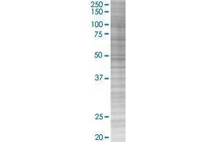 CABC1 transfected lysate. (CABC1 293T Cell Transient Overexpression Lysate(Denatured))