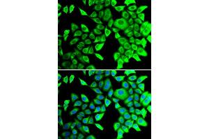 Immunofluorescence analysis of A549 cell using THADA antibody. (THADA Antikörper)