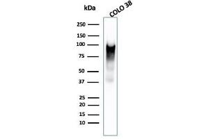 Western Blot Analysis of COLO-38 cell lysate using gp100 Mouse Monoclonal Antibody (PMEL/2038). (Melanoma gp100 Antikörper  (AA 376-502))