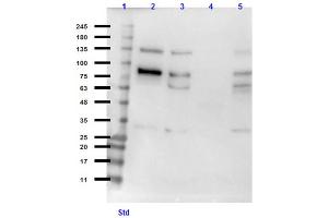 Western Blotting (WB) image for anti-Polo-Like Kinase 1 (PLK1) antibody (ABIN6655434)