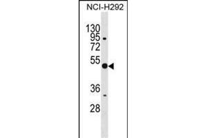 ANXA10 Antibody (C-term) (ABIN1536993 and ABIN2850044) western blot analysis in NCI- cell line lysates (35 μg/lane). (Annexin a10 Antikörper  (C-Term))