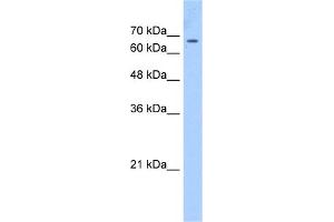 WB Suggested Anti-CDY1 Antibody Titration:  2. (CDY1 Antikörper  (C-Term))