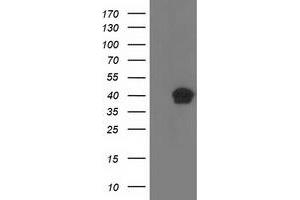 HEK293T cells were transfected with the pCMV6-ENTRY control (Left lane) or pCMV6-ENTRY RLBP1 (Right lane) cDNA for 48 hrs and lysed. (RLBP1 Antikörper)