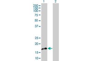 Western Blot analysis of FGF1 expression in transfected 293T cell line by FGF1 MaxPab polyclonal antibody. (FGF1 Antikörper  (AA 1-155))