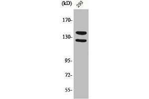 Western Blot analysis of 293 cells using Phospho-Flg (Y154) Polyclonal Antibody (FGFR1 Antikörper  (pTyr154))