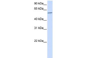 WB Suggested Anti-PPP3CA Antibody Titration:  0. (PPP3CA Antikörper  (N-Term))