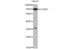 Western blot analysis of extracts of HepG2 cells, using CACNB1 Antibody. (CACNB1 Antikörper  (AA 429-598))