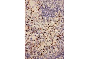 Immunohistochemistry (IHC) image for anti-CD68 Molecule (CD68) (AA 312-326), (Middle Region) antibody (ABIN3044428)