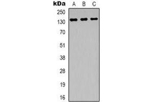 Western blot analysis of ABL1 expression in Hela (A), SHSY5Y (B), NIH3T3 (C) whole cell lysates. (ABL1 Antikörper)