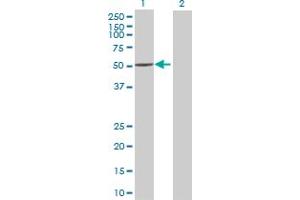 Lane 1: ALDH3A2 transfected lysate ( 55. (ALDH3A2 293T Cell Transient Overexpression Lysate(Denatured))