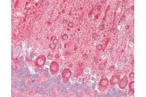 Mouse Brain, Cerebellum: Formalin-Fixed, Paraffin-Embedded (FFPE) (TRAF6 Antikörper  (AA 1-305))