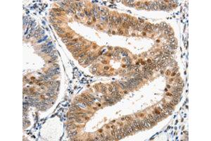 Immunohistochemistry (IHC) image for anti-Damage Specific DNA Binding Protein 1 (DDB1) antibody (ABIN1872221) (DDB1 Antikörper)