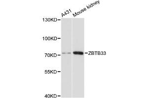 Western blot analysis of extracts of various cell lines, using ZBTB33 antibody. (ZBTB33 Antikörper)