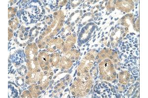 KHK antibody was used for immunohistochemistry at a concentration of 4-8 ug/ml. (Ketohexokinase Antikörper)