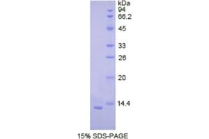 SDS-PAGE analysis of Human Cadherin, Neuronal Protein. (N-Cadherin Protein)