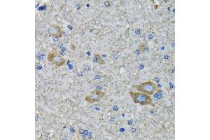 Immunohistochemistry of paraffin-embedded mouse spinal cord using SSBP1 antibody (ABIN5974202) at dilution of 1/100 (40x lens). (SSBP1 Antikörper)