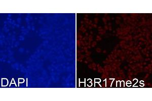 Immunofluorescence analysis of 293T cells using Symmetric DiMethyl-Histone H3-R17 antibody (ABIN3017470, ABIN3017471, ABIN3017472 and ABIN6220102). (Histone 3 Antikörper  (H3R17me2))