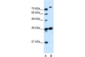 WB Suggested Anti-SLC9A7 Antibody Titration:  0. (NHE7 Antikörper  (N-Term))